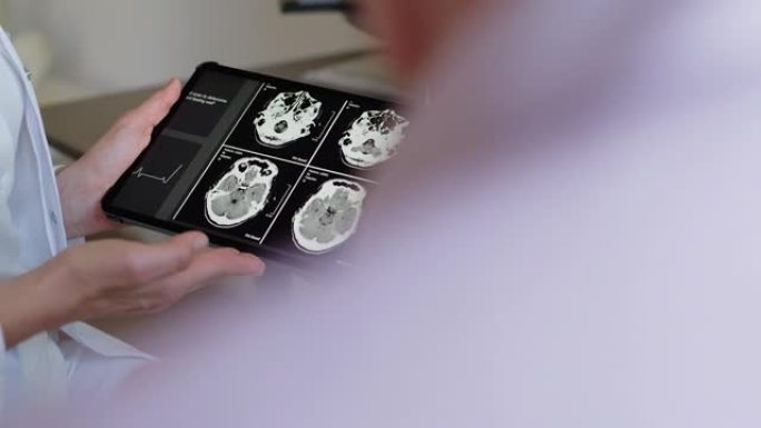 无法识别的医生向患者显示数字平板电脑中的CAT扫描结果