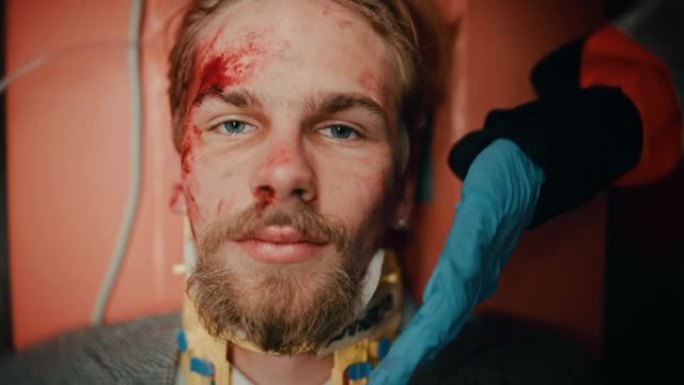 一名受伤的年轻男性患者脸上有血迹的强烈肖像。躺在医院担架上时留着胡须看着相机的受伤男子。他神志清醒，