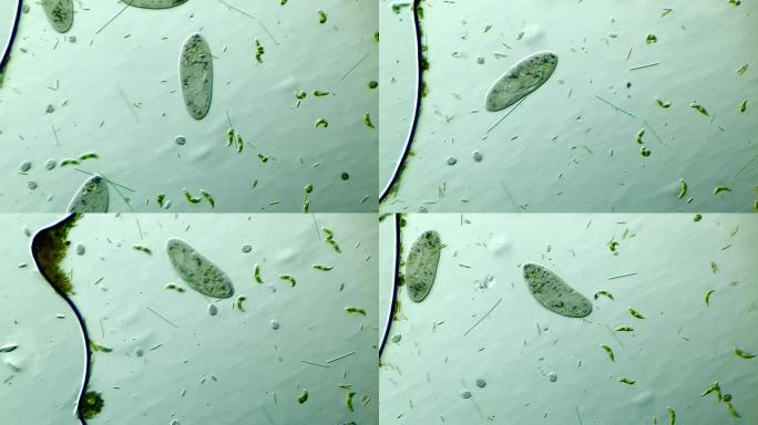 显微镜下放大100倍的微生物草履虫和眼虫