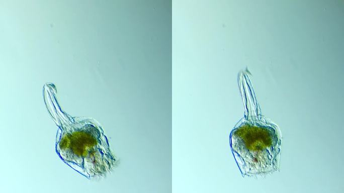 显微镜下放大100倍的轮虫（明场）