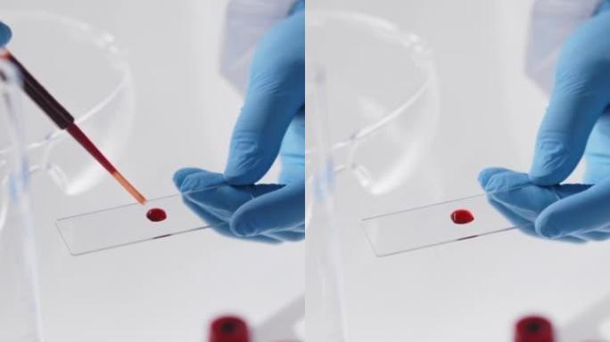 一只手戴着防护手套的特写镜头，将一滴血放在显微镜载玻片上，靠在发光的白色桌子上，上面装有试管架