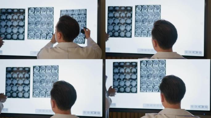 一组医生正在检查脑部断层扫描