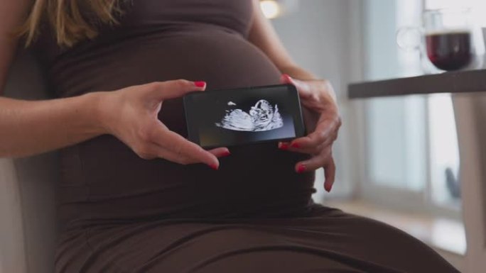 孕妇在家拿着手机的特写带婴儿超声波扫描