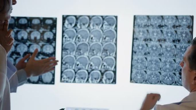 一组医生正在检查脑部断层扫描
