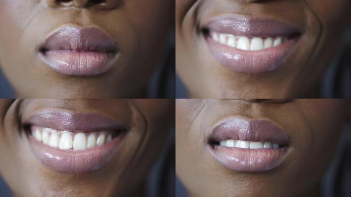 特写，微笑和牙齿的黑人妇女的嘴美容，牙科和化妆品牙科。牙齿清洁，美白和卫生，快乐女孩的嘴唇微笑，用于