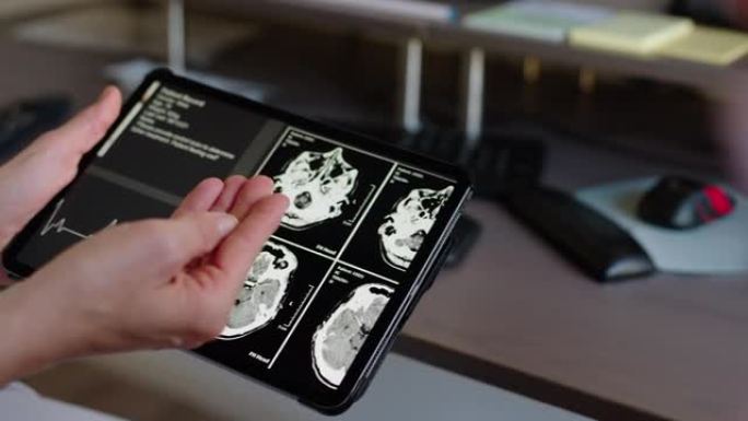 神经科医生与临床患者讨论数字平板电脑的MRI扫描结果