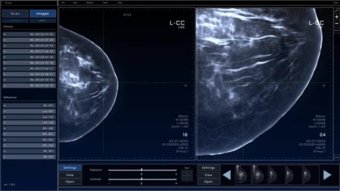 乳房x线照片乳房扫描模型，具有多个窗口和数据。具有x射线扫描结果的医学研究环境软件，用于计算机显示器