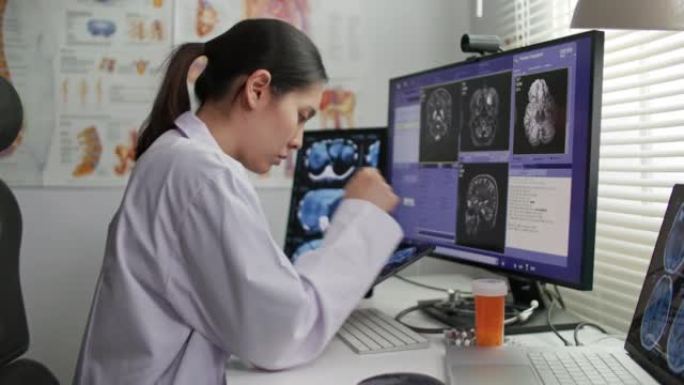 女性放射科医生分析医院的头部扫描