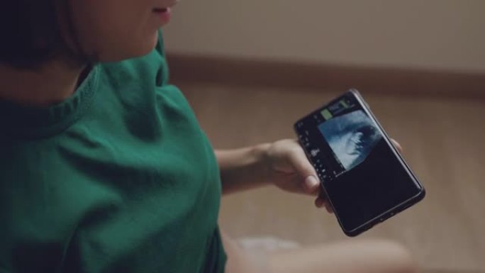 年轻的妈妈怀孕了，在智能手机上看超声波图像。