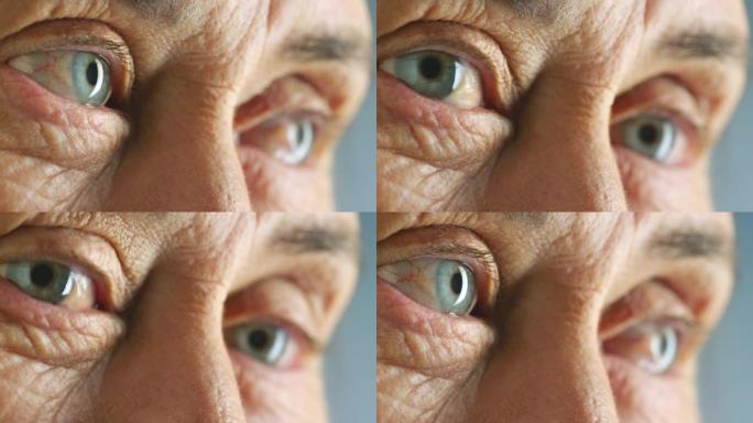 老年妇女的眼睛，精神卫生差，眨眼，健忘或困惑。不高兴的眼睛周围皮肤上疲倦的皱纹特写，显示压力，乏力甚