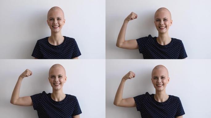秃头女人克服了癌症疾病，举起手臂显示二头肌力量