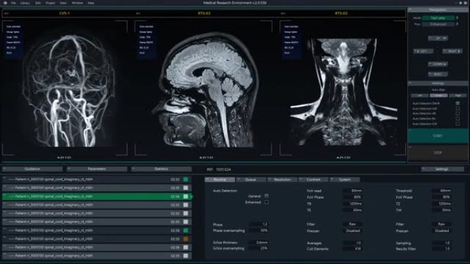 显示大脑磁共振图像扫描实时过程的医疗软件界面。真实的MRI有助于诊断神经系统疾病，肿瘤，损伤，中风，