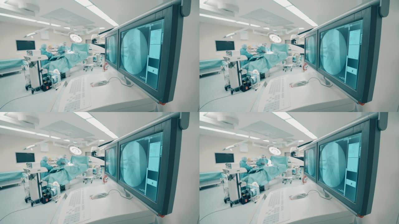 手术室配有骨扫描的监视器