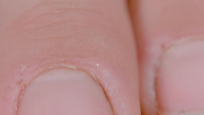宏，dop: 白人手指干裂的高清特写视图。