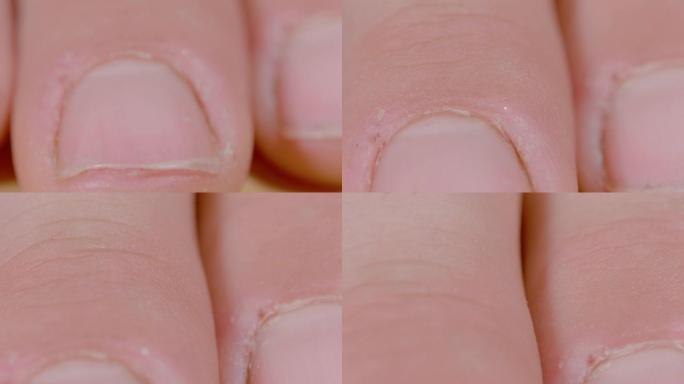 宏，dop: 白人手指干裂的高清特写视图。
