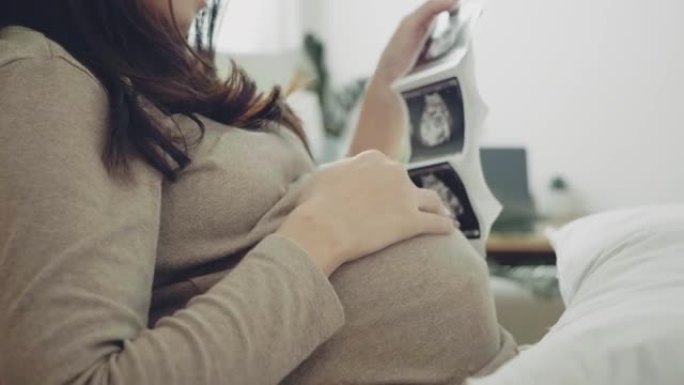 孕妇有超声膜。产检胎教拍片