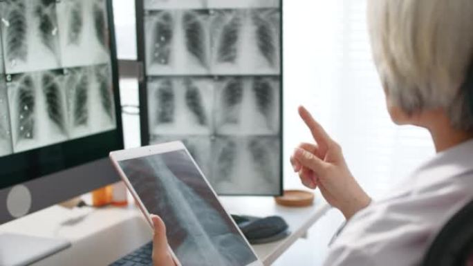 高级女医生向患者看平板电脑上的肺部扫描