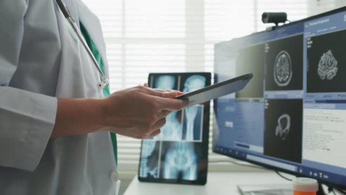 特写医生使用大屏幕查看医疗保健图像 & 用x射线成像ct扫描的运动图像