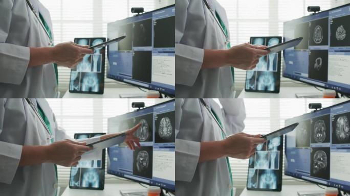 特写医生使用大屏幕查看医疗保健图像 & 用x射线成像ct扫描的运动图像