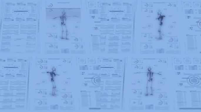 数字医疗小组。通过深度扫描方法研究人体的医学系统。骨骼系统的数字模型显示在显示屏上。