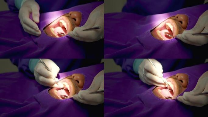 男人和牙医检查牙齿。