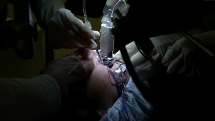 激光眼科手术步骤6: 机械刀片切割角膜瓣