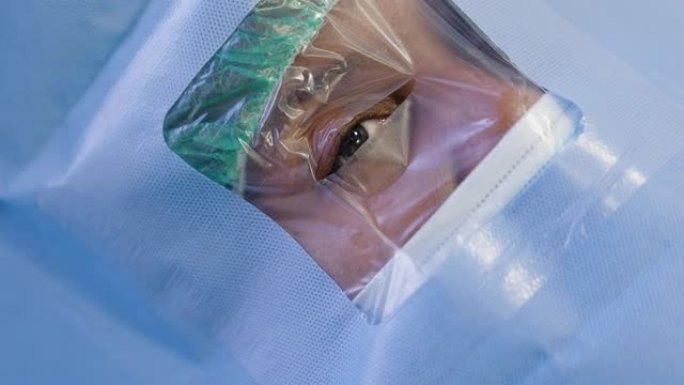 一名女性患者的特写镜头，脸上有手术盖布，用于眼科手术