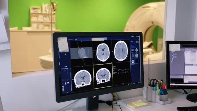 临床计算机监视器上的MRI扫描图像