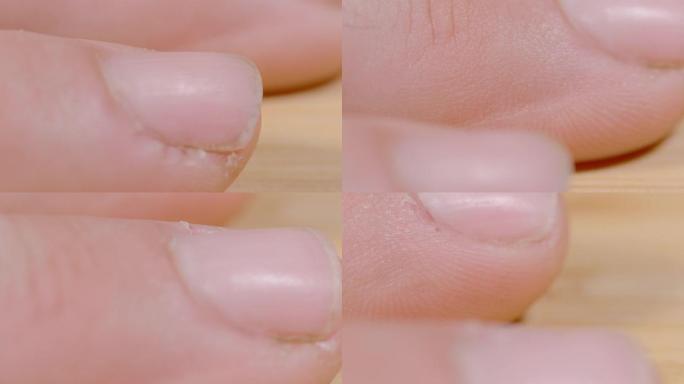 MACRO，dop: 无法识别的人的手指已被体力劳动损坏。