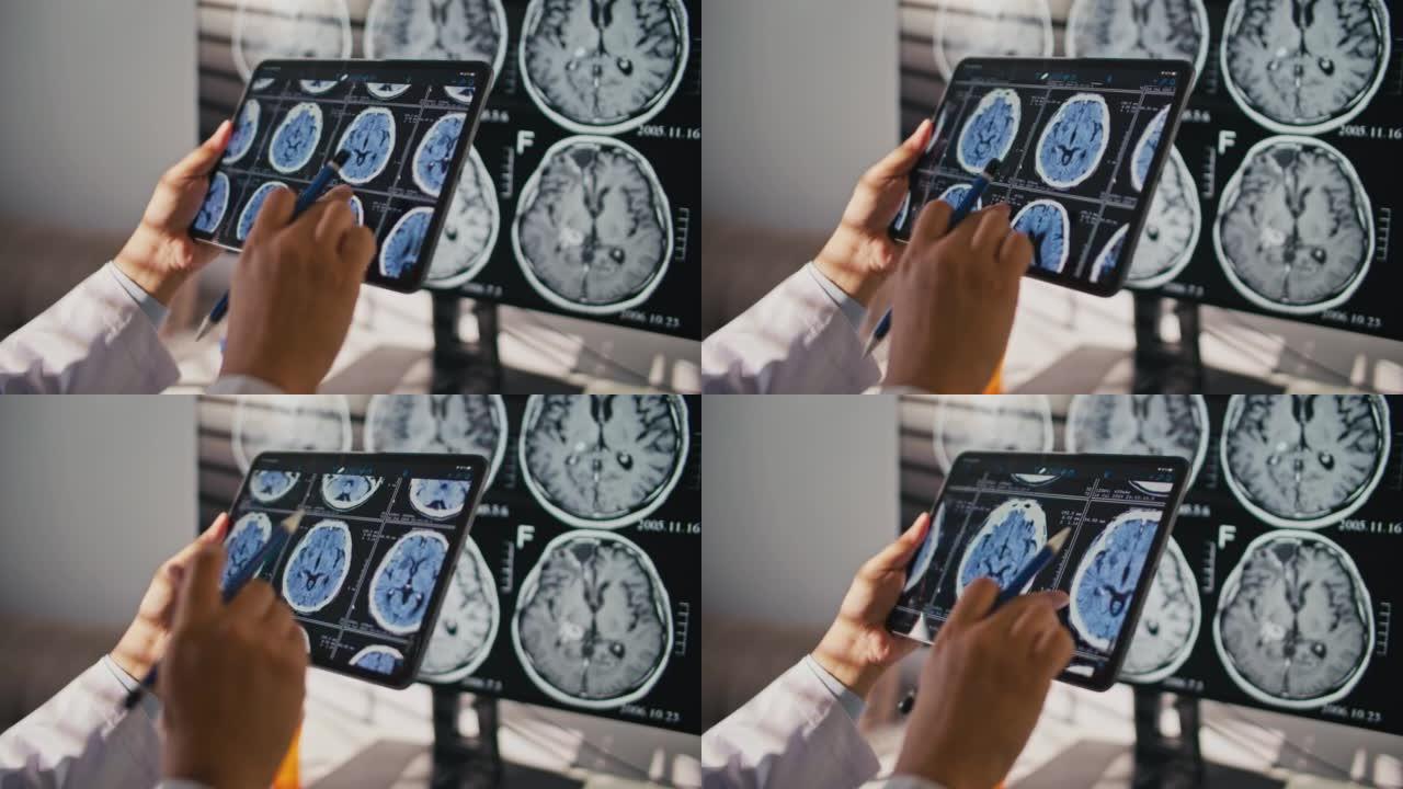 医生用数字平板电脑检查患者胸部肺炎或癌症的x光脑部扫描图像。