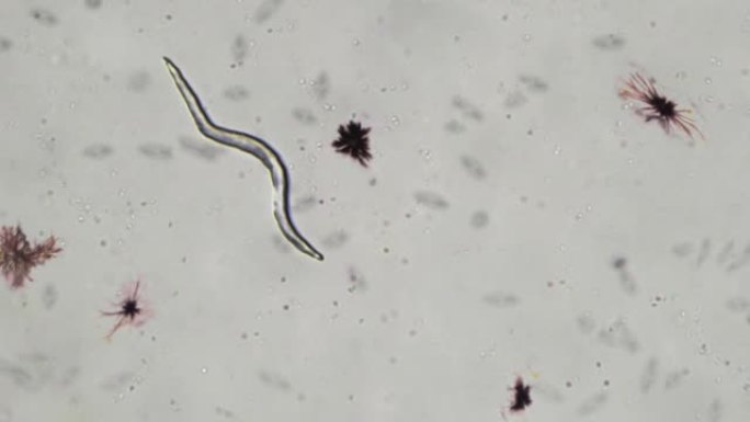 寄生蠕虫和其他微生物