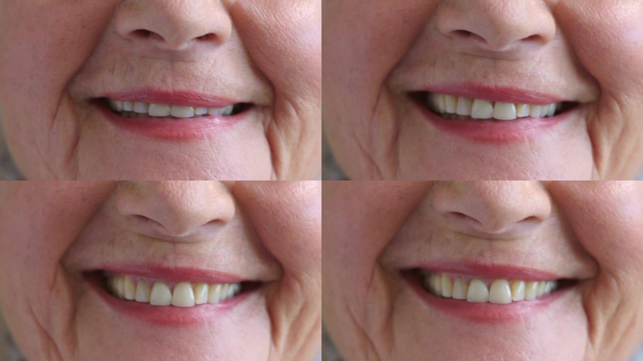 由于不健康的习惯而有牙齿问题和黄色牙齿的高级女性。一位口腔卫生不良的老年女性需要牙医检查的特写镜头。