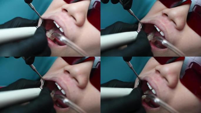 亚洲华裔女牙医在患者牙齿上注射