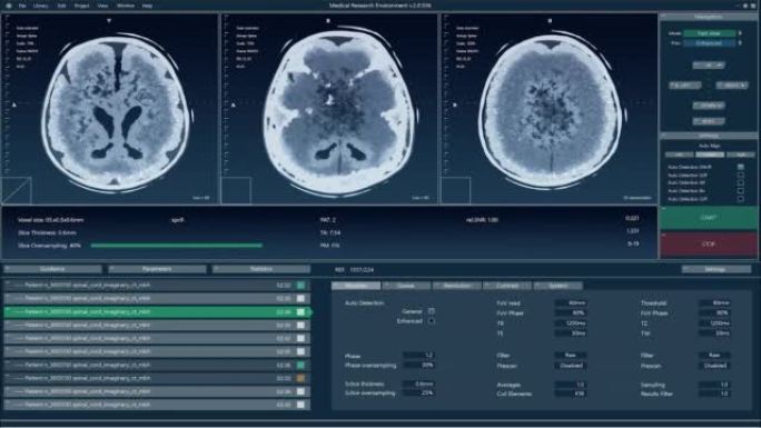 具有多个窗口和数据的磁共振成像脑扫描模型。具有用于计算机显示器和笔记本电脑屏幕的MRI结果的医学研究