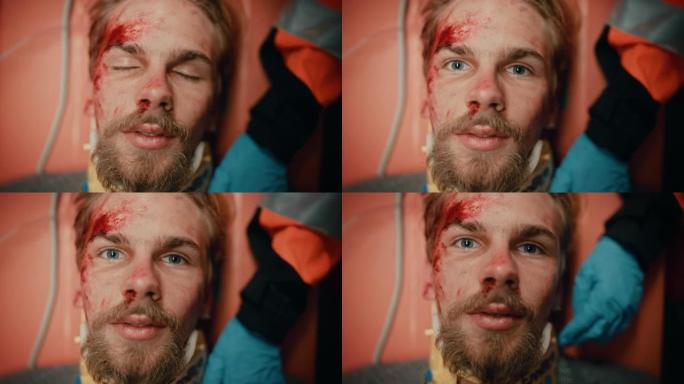 一名受伤的年轻大胡子男性患者脸上有血迹的强烈肖像。受伤的男子睁开眼睛，在医院的担架上复活。死亡的概念