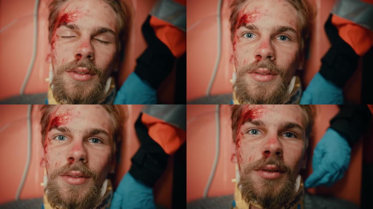 一名受伤的年轻大胡子男性患者脸上有血迹的强烈肖像。受伤的男子睁开眼睛，在医院的担架上复活。死亡的概念