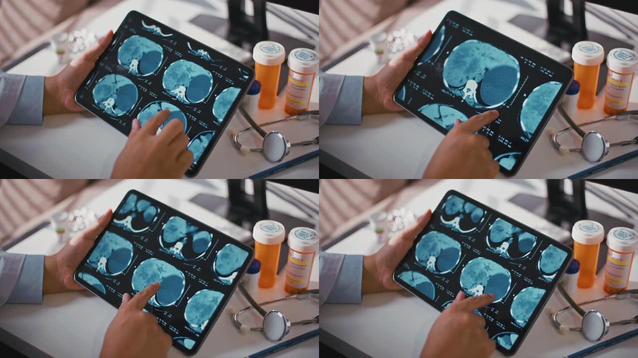 医生通过数字平板电脑上的大脑x射线图像的x射线检查