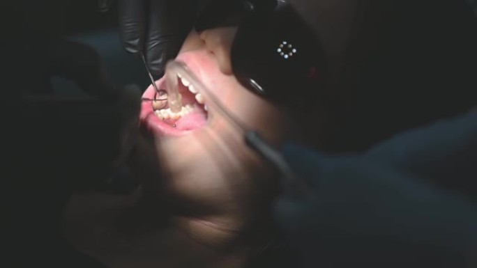 中国少女张口的牙科检查