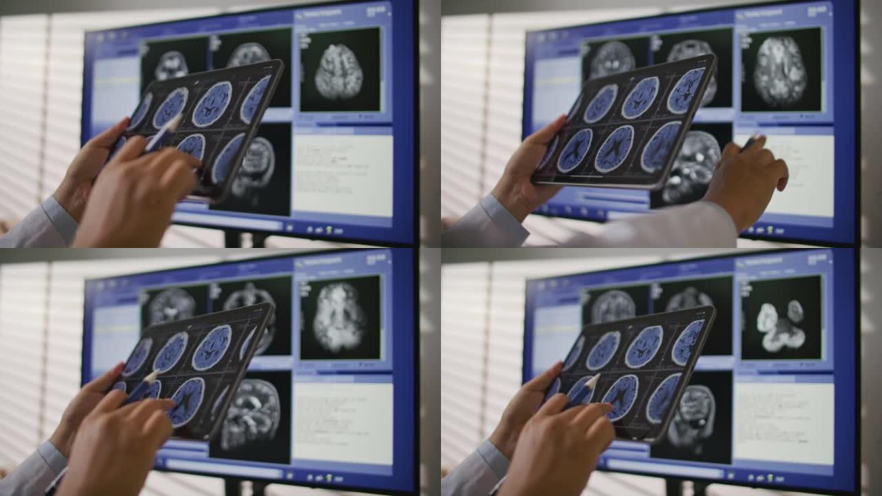 近距离医生分析数字平板电脑上的MRI扫描