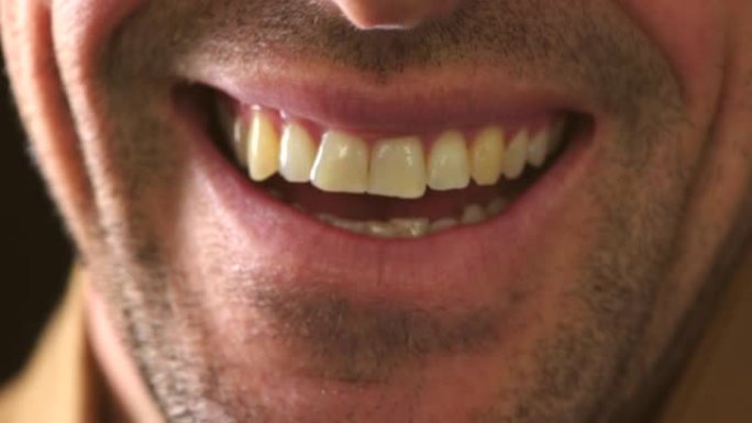 黄色牙齿和面部毛发的笑人的口腔特写。一个快乐微笑的男性面部细节的头像，下巴和脸颊没有剃光，在牙医那里