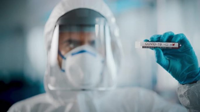 病毒学研究科学家穿着工作服，手术手套，面罩和防护罩显示试管中带有标记为新型冠状病毒肺炎阳性的血液样本