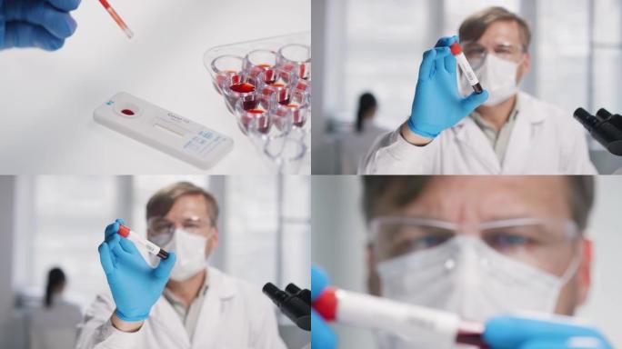 新型冠状病毒肺炎测试血液的科学家序列