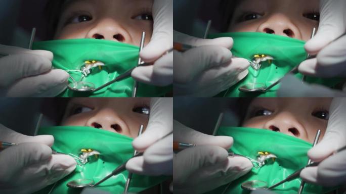 牙医治疗牙齿小男孩特写，