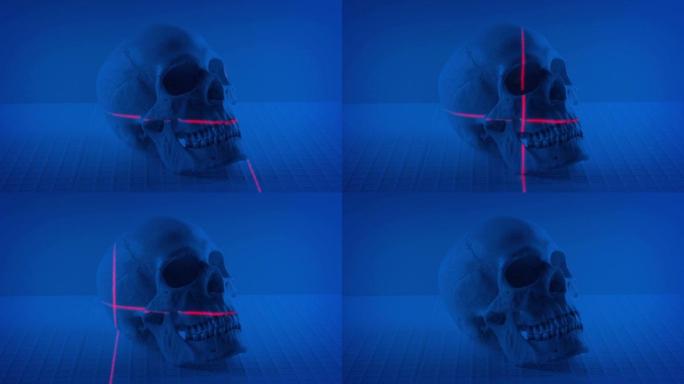 激光在实验室中扫描头骨