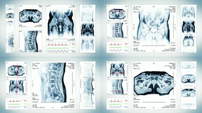 骨盆MRI扫描。顶部，正面和侧面视图。白色