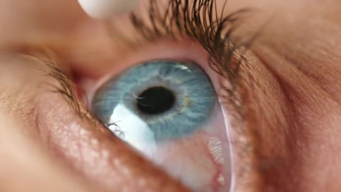 眼部护理，视力药物和眼药水可帮助解决视力问题，疾病或问题特写。眼科，眼科健康和药物支持过敏，青光眼或