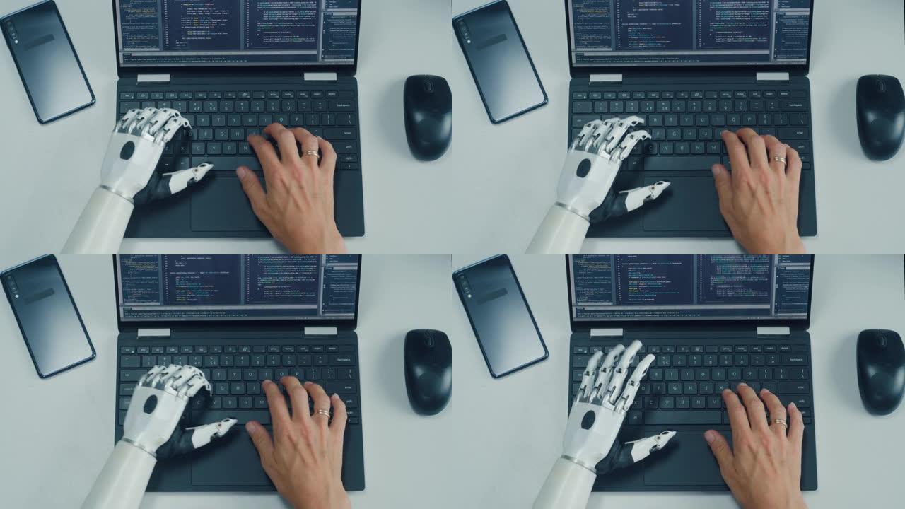 空中俯视图: 专业残疾程序员使用假肢在笔记本电脑上工作。专家快速和自然地使用肌电仿生手为软件键入代码