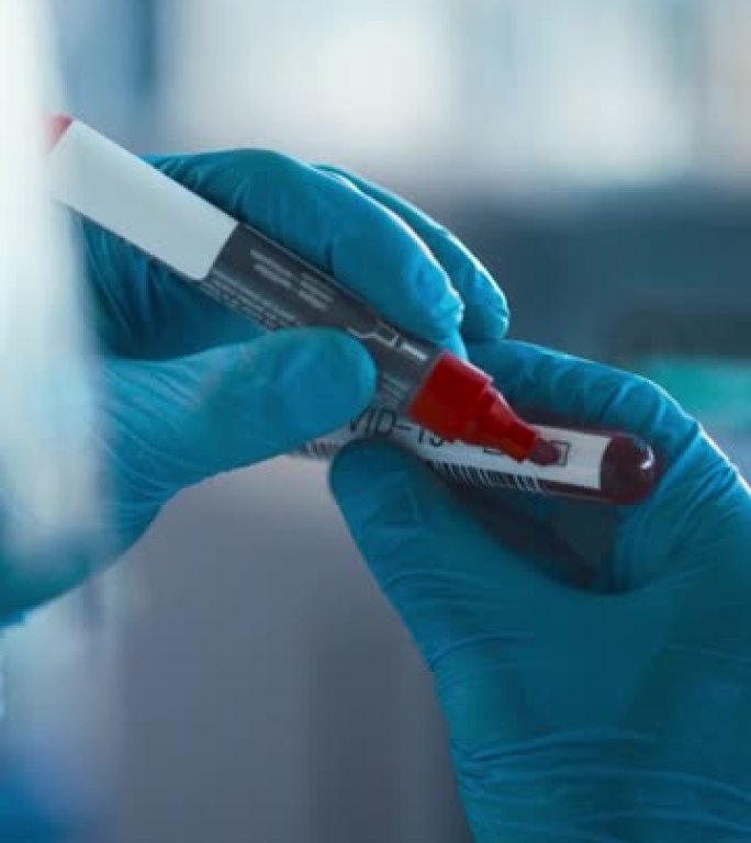 新型冠状病毒肺炎测试分析: 药物和疫苗开发医学研究科学家穿着工作服和手术手套，用血液试管标记为阳性。