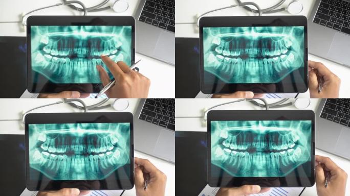 牙医检查牙齿不适患者的口腔x射线