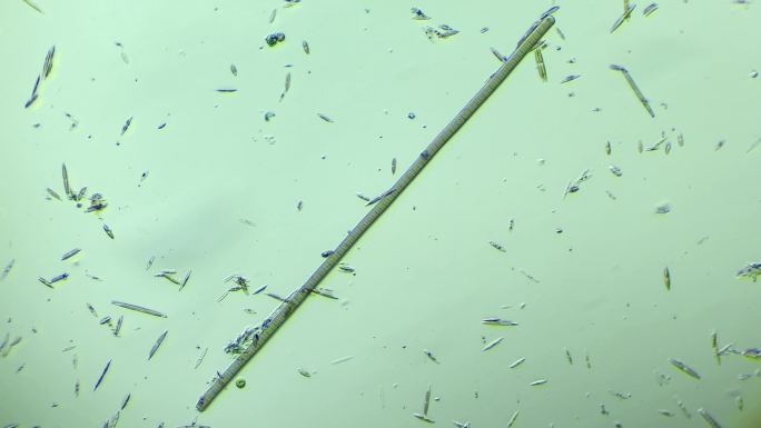 显微镜下放大100倍的微生物颤蓝细菌
